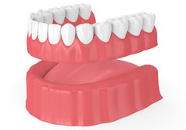 抜歯後の治療-入れ歯